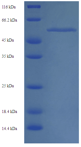 Norovirus Capsid Protein VP1 (Recombinant 6His, N-terminus)