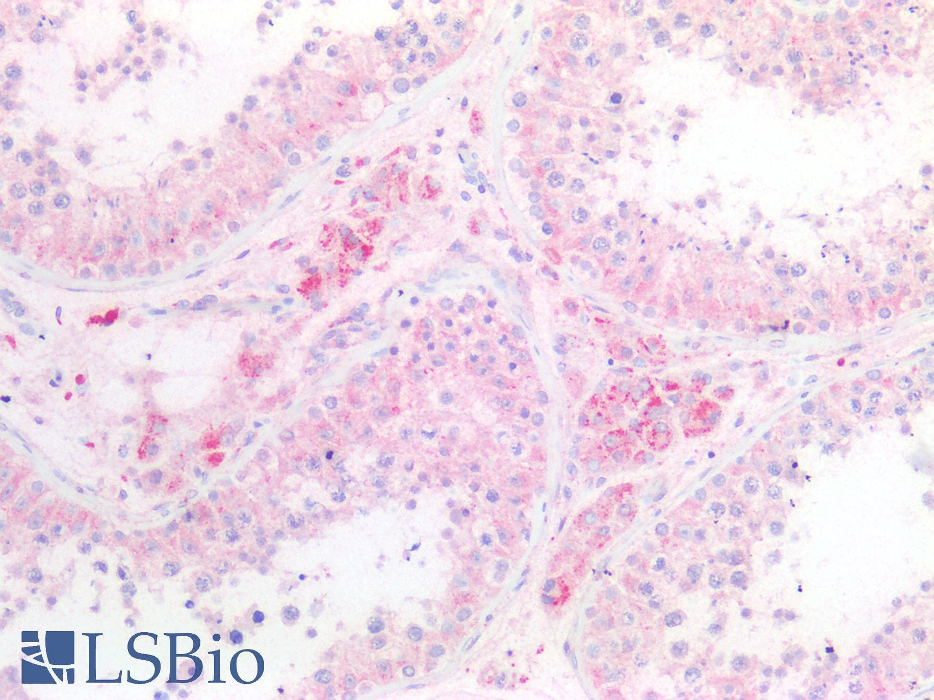 IHC-plus™ Polyclonal Rabbit anti-Human SERP1 Antibody (N-Terminus, IHC, WB)