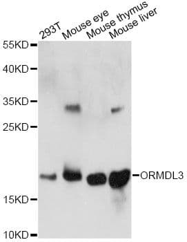 ORMDL3 Antibody