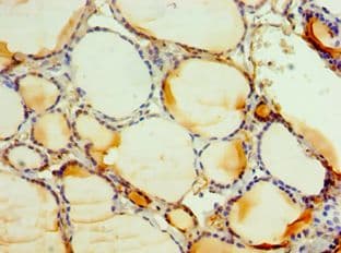Polyclonal Rabbit anti-Human C3AR / C3a Receptor Antibody (aa160-340, IHC)