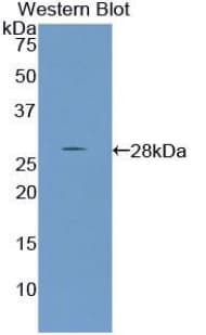 PTHLH / PTHRP Antibody (aa37-177)