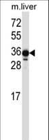 LIMS2 Antibody (aa309-337)