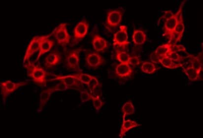 ABCA8 Antibody