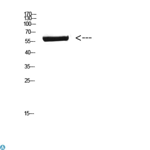 CYP26B1 Antibody