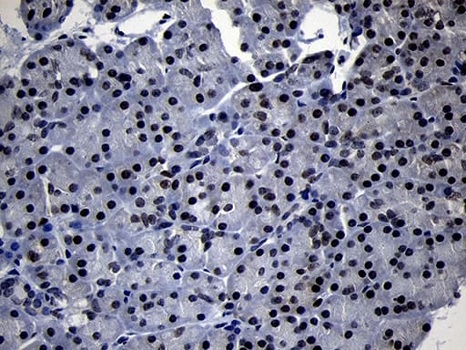 Monoclonal Mouse anti-Human TCF12 / HEB Antibody (clone OTI2E11, Carrier-free, IHC, WB)