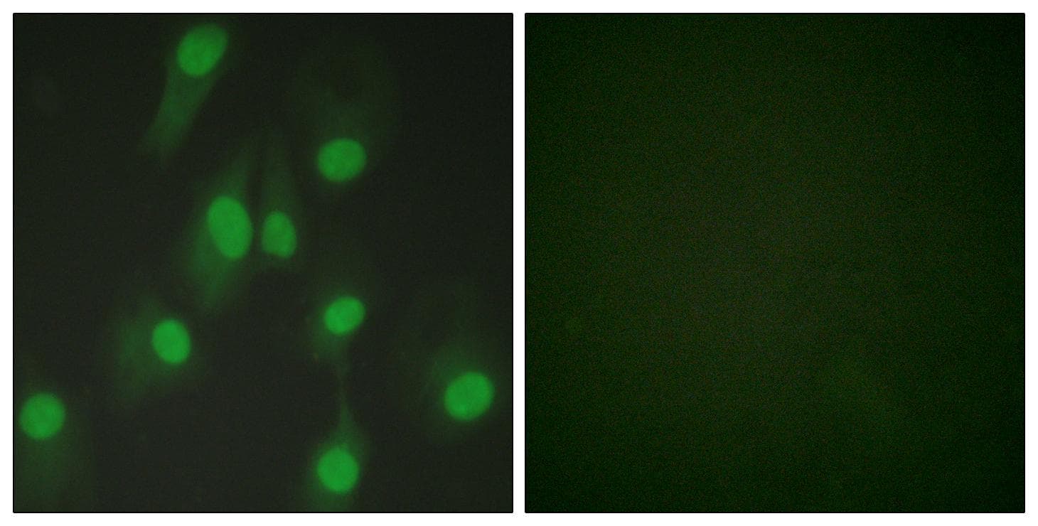 CHEK1 / CHK1 Antibody (p286)
