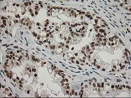 ERCC4 / XPF Antibody (clone OTI4E11)