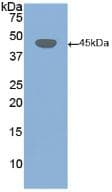 DSG3 / Desmoglein 3 Antibody (aa858-999)