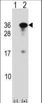 Polyclonal Rabbit anti-Human RYBP Antibody (aa1-30, WB)