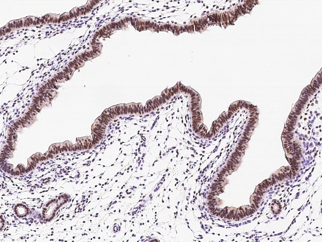 TWIST1 / TWIST Antibody (Preservative Free)