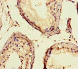 ELK1 Antibody