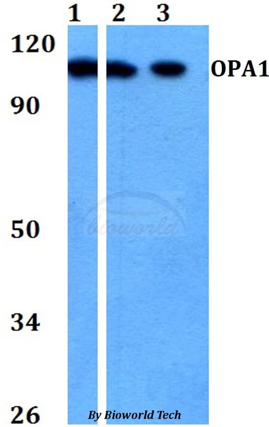Polyclonal Rabbit anti-Human OPA1 Antibody (WB)