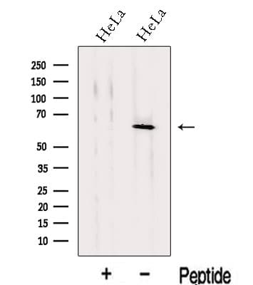 KLHL18 Antibody