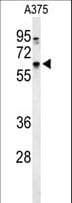 DCT / Dopachrome Tautomerase Antibody (aa62-89)