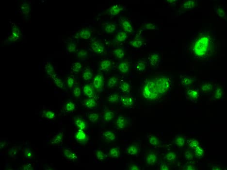 NELFE / RD / RDBP Antibody