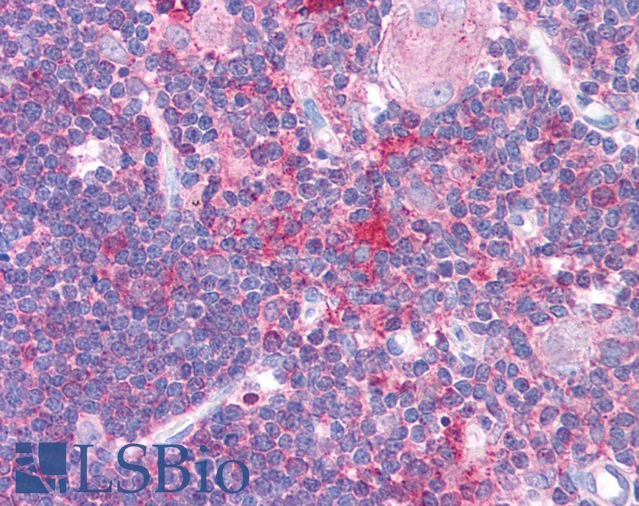 HDAC6 Antibody (aa69-118)