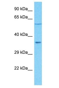 Polyclonal Rabbit anti-Human OR5R1 Antibody (aa239-288, WB)