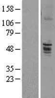 ENTPD6 Protein (Over-Expression Lysate Myc-DDK (Flag))