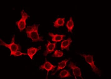 CLDN10 / Claudin 10 Antibody