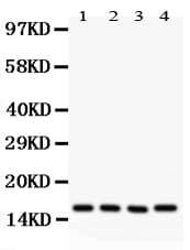 CAV2 / Caveolin 2 Antibody (aa1-162)