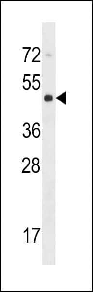 Polyclonal Rabbit anti-Human CYTH4 / PSCD4 Antibody (aa291-319, WB)