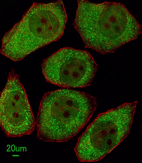 IHC-plus™ ALOX12 / 12 Lipoxygenase Antibody (aa618-650)
