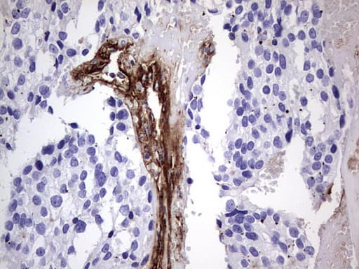 VWF / Von Willebrand Factor Antibody (aa764-1263, clone OTI6C7)