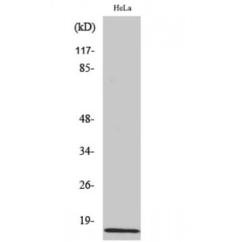 IAPP / Amylin Antibody (10-90 aa, N-terminal)