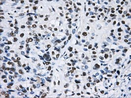 HNRNPF / hnRNP F Antibody (clone OTI5F5)