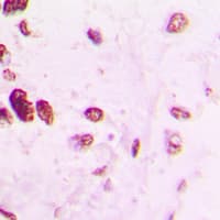 TFAP2A + TFAP2B Antibody (C-Terminus)