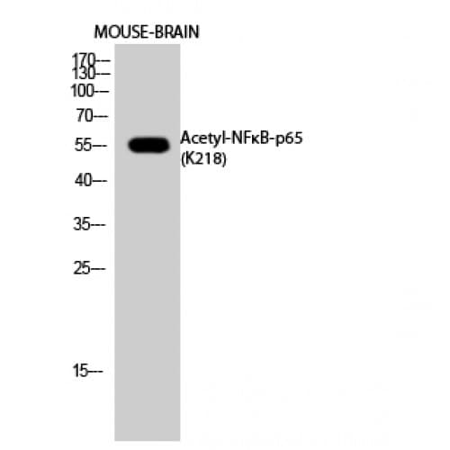 RELA / NFKB p65 Antibody (acetylation site of K218.)