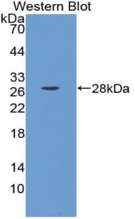 ESAM Antibody (aa31-390, PE)