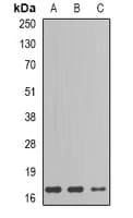 IHC-plus™ Polyclonal Rabbit anti-Human Gastric Inhibitory Peptide Antibody (IHC, WB)