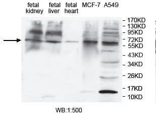 Polyclonal Rabbit anti-Human ZNF460 Antibody (aa207-507, IHC, WB)