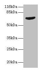 GRK4 Antibody (aa1-245)