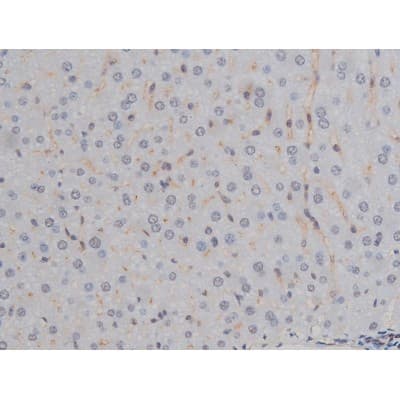Polyclonal Rabbit anti-Human CHUK / IKKA / IKK Alpha Antibody (phospho-Ser180,phospho-Ser181, IHC, IF, WB)