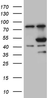 FCRLB / FREB-2 Antibody (aa202-426, clone OTI6H8)