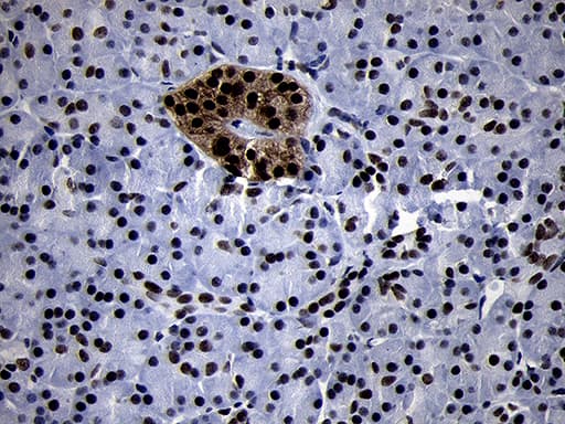SMC1A / SMC1 Antibody (aa889-1016, clone OTI5A1)