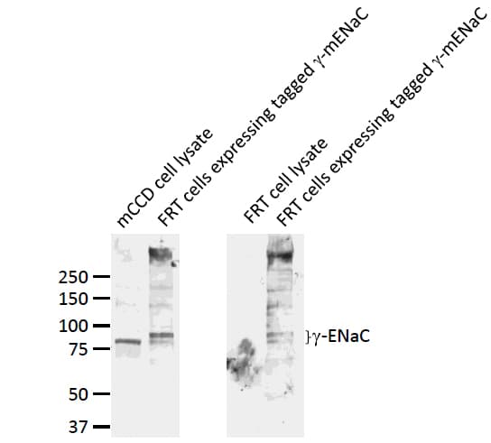 SCNN1G / ENaC Gamma Antibody