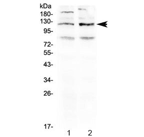 GABBR1 / GABA B Receptor 1 Antibody