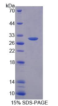 Human ABCC10 Protein (Recombinant His-T7)