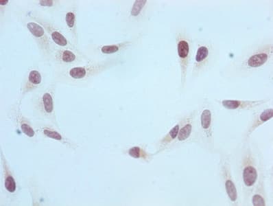 Recombinant Monoclonal Rabbit anti-Human HIST1H3A Antibody (IF, WB)