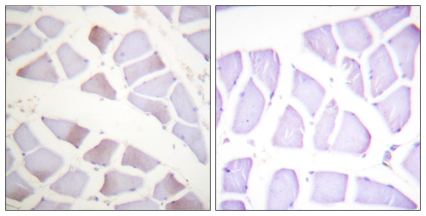 Polyclonal Rabbit anti-Human CRYAB / Alpha B Crystallin Antibody (phospho-Ser19, IHC, WB)