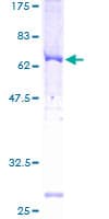 Human ADRBK2 / GRK3 Protein (Recombinant GST)