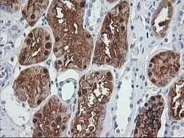 ACY1 / Aminoacylase 1 Antibody (clone OTI2D3)