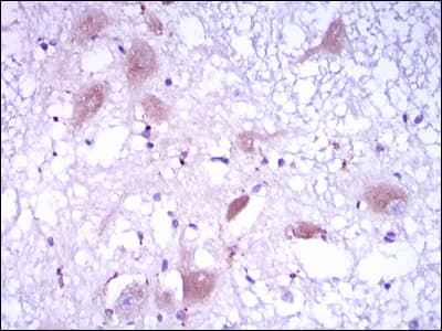 DKK3 Antibody (clone 8A5C6)