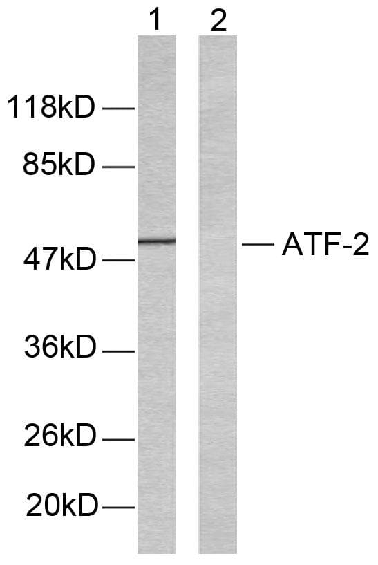ATF2 Antibody (p51/53)