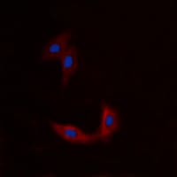 IHC-plus™ ETK / BMX Antibody (N-Terminus)
