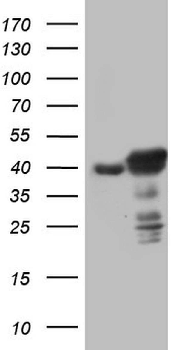 TP53 / p53 Antibody (clone OTI7A2)