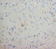 OX1R / Orexin Receptor 1 Antibody (aa1-80)